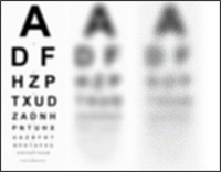 Amblyopia Revisited…
